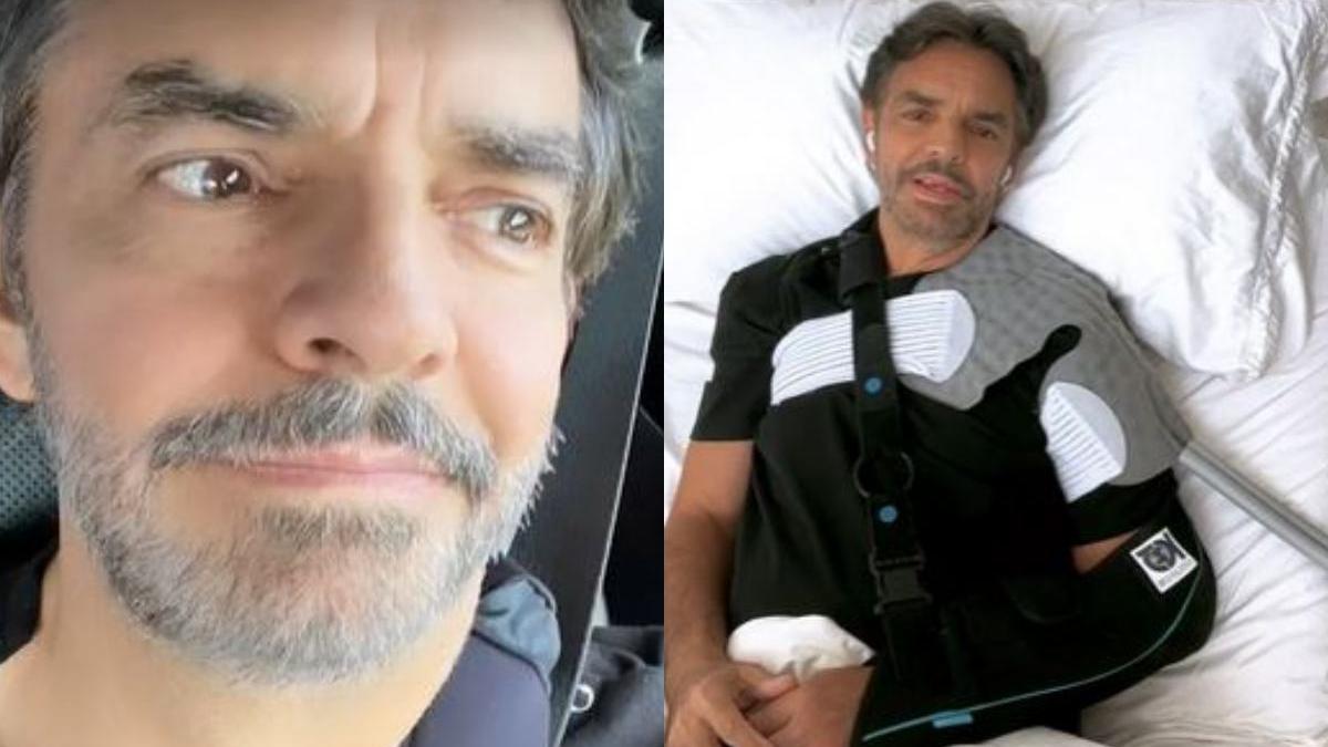 Eugenio Derbez | Hace mes y medio, el actor mexicano sufrió un aparatoso accidente.