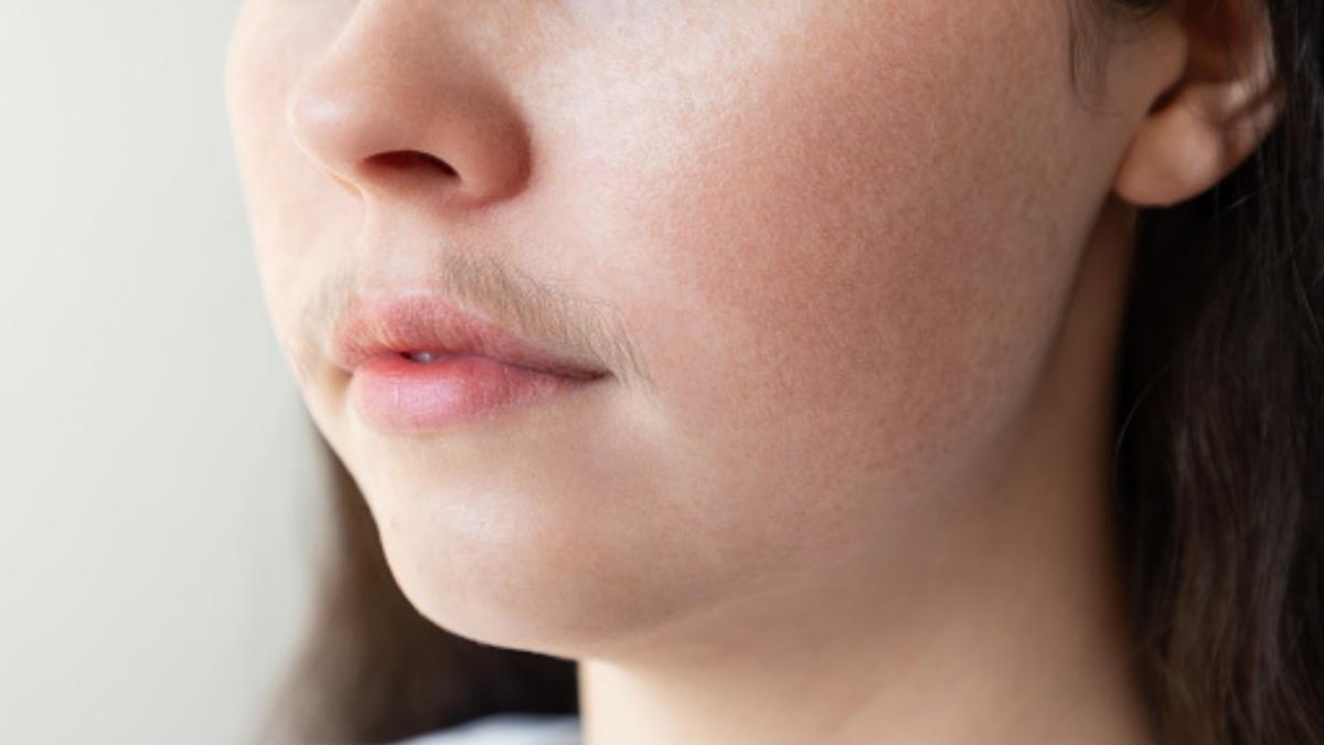  | La aparición repentina de abundante vello facial en las mujeres, como el bigote, podría evidenciar que algo anda mal con el estado de salud.