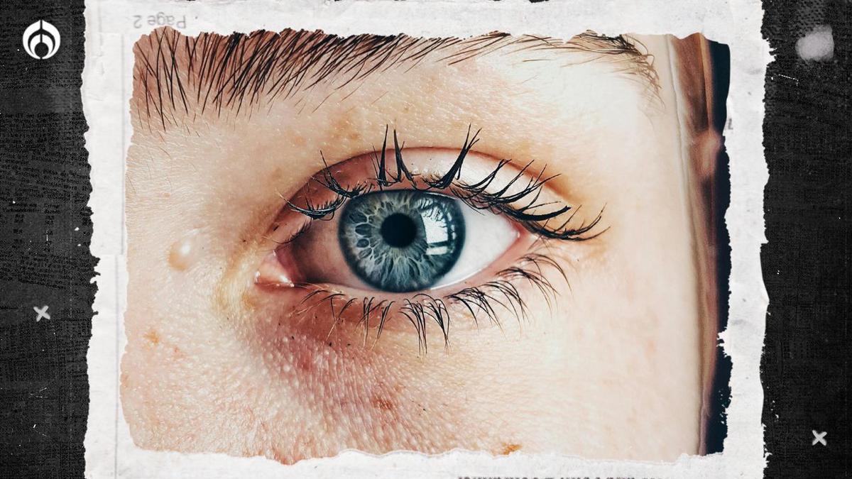 El cuidado de los ojos | Ir a consulta oftalmológica es vital
Foto: Pexels