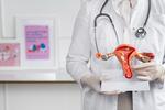 ¿Cuáles son los síntomas de la endometriosis? La enfermedad que afecta a 10% de las mujeres