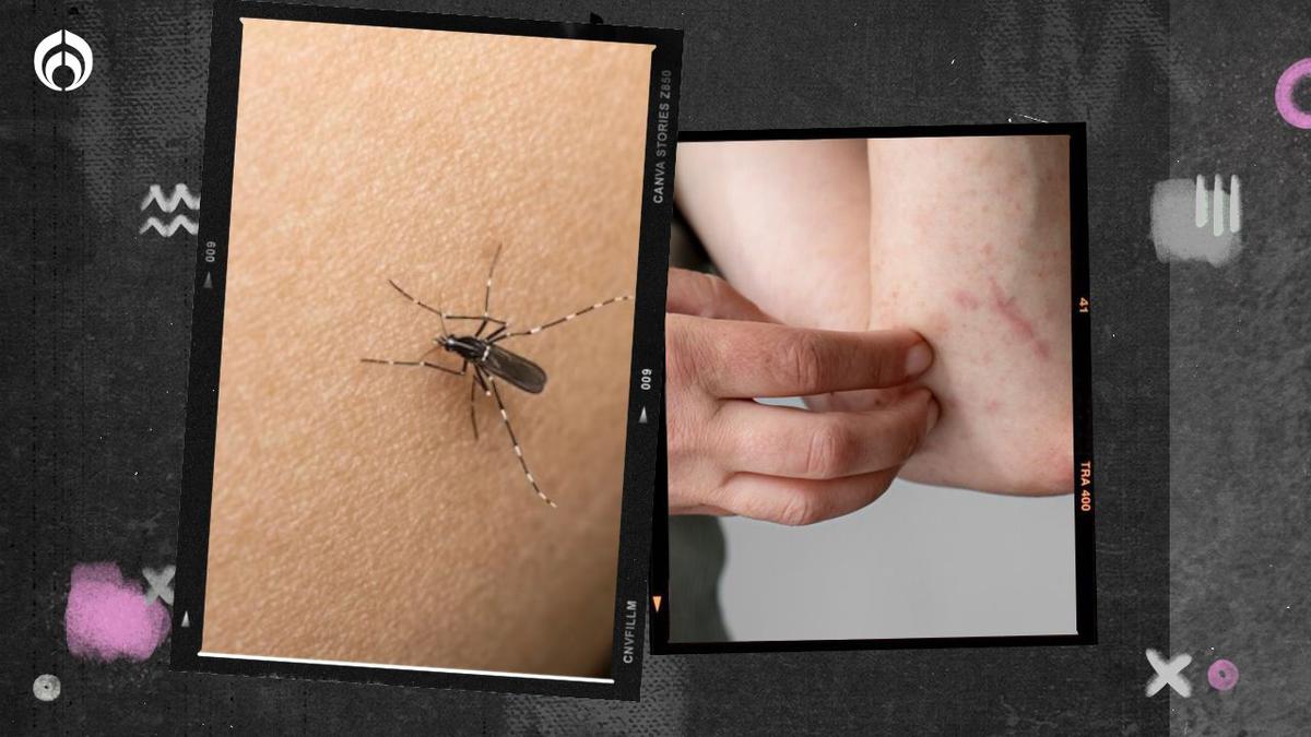 Picaduras | Las picadas de insectos son muy peligrosas. | fuente: freepik