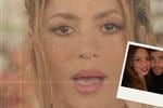 ¿A qué tratamiento médico se sometió Shakira tras ruptura con Piqué? El Nacional de Catalunya lo revela