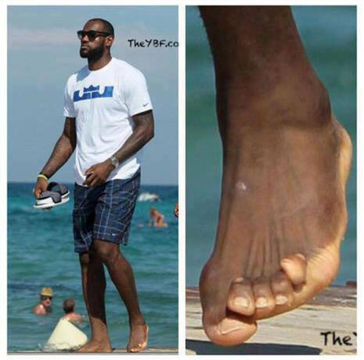 Lebron James | Así lucen los pies de la estrella de la NBA fuente: X @luzugames