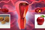 5 alimentos que debes comer si tienes síndrome de ovario poliquistico