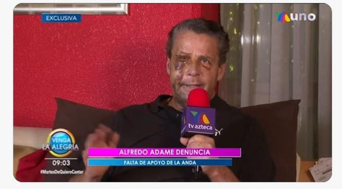  | Alfredo Adame se está recuperando de la cirugía a la que fue sometido.