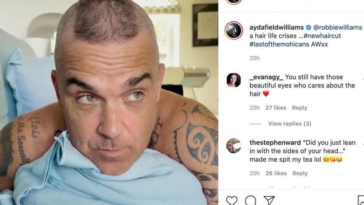 Robbie Williams ha dejado entrever su problema de calvicie en redes sociales.